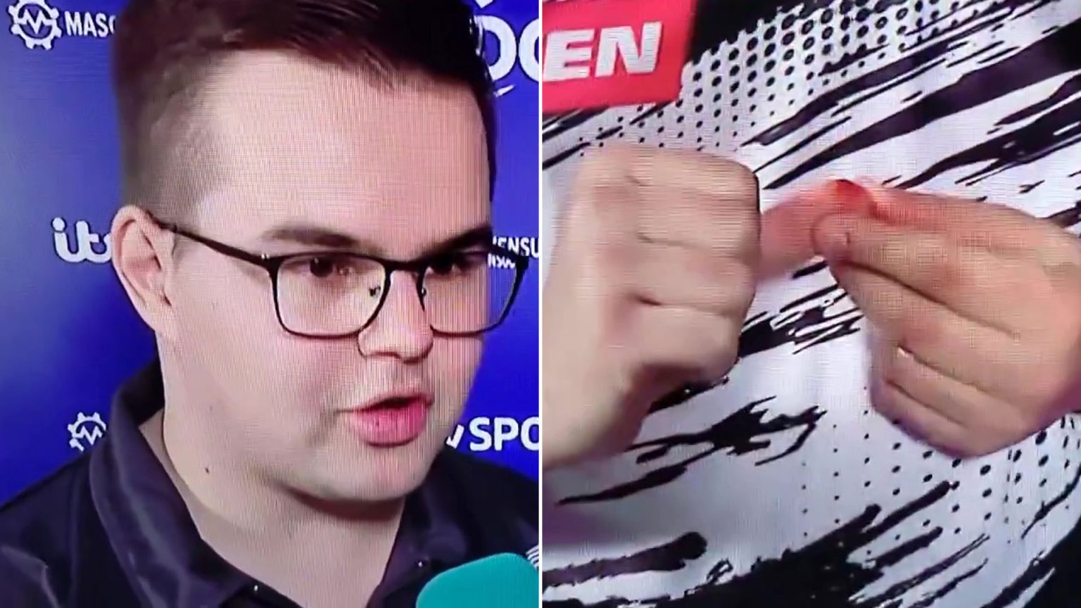Darts star Gian van Veen shows off gruesome cut live on TV before stunning Luke Humphries to win European Championship