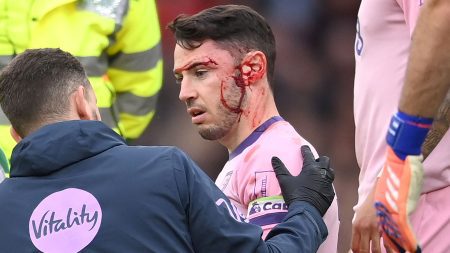 Adam Smith health update after Bournemouth star’s face left covered in blood following collision with team-mate