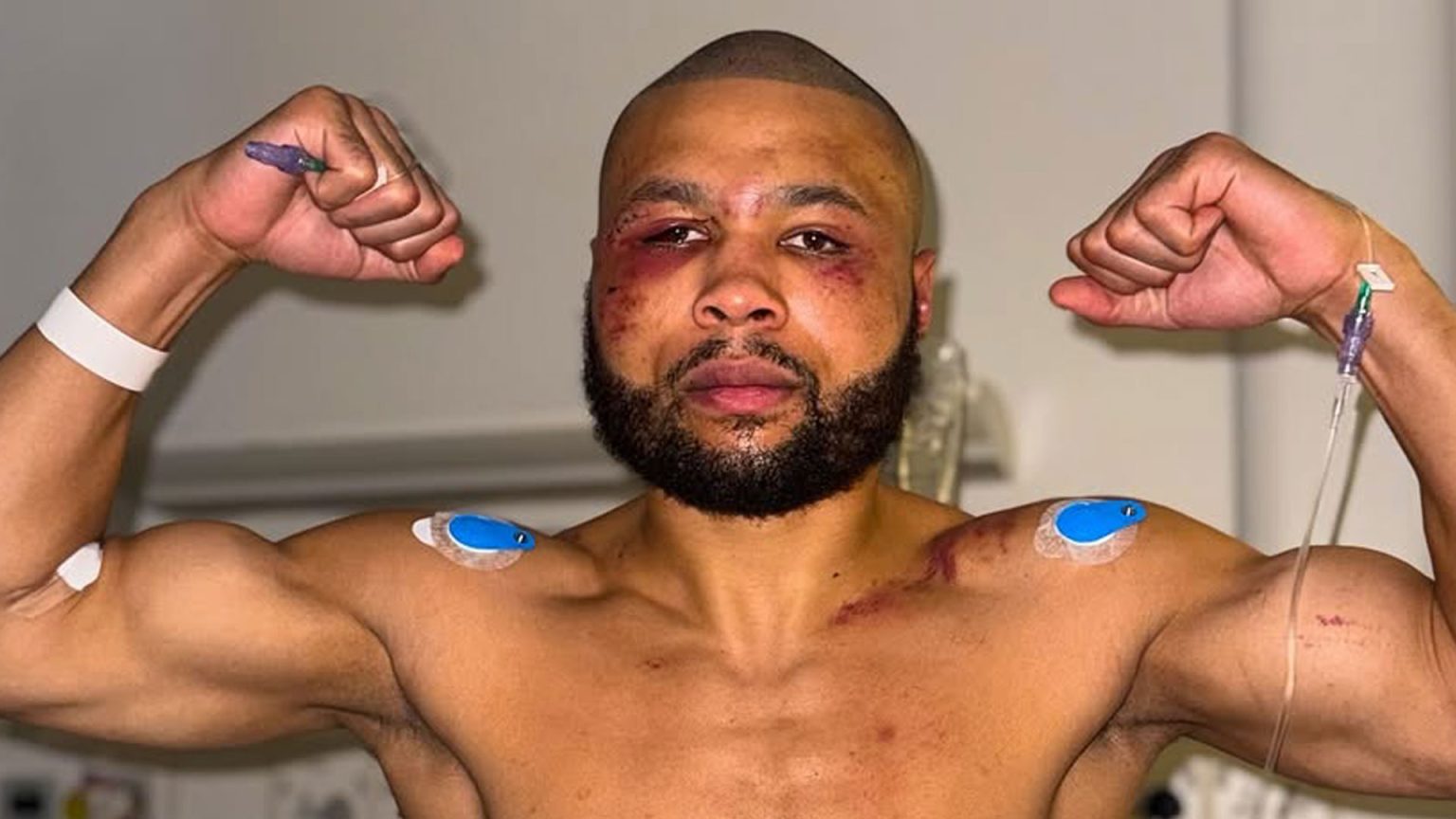 Chris Eubank Jr shares horror injuries from hospital after Conor Benn fight in bid to ‘shine light on the situation’