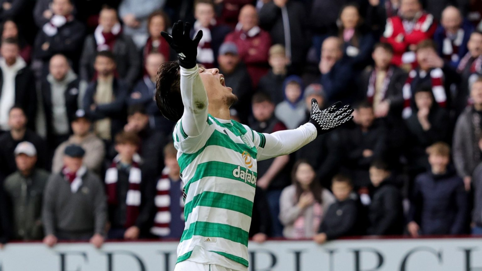 Forgotten Celtic star makes shock start for B TEAM in cup clash as fans blast ‘this isn’t what he had in mind’