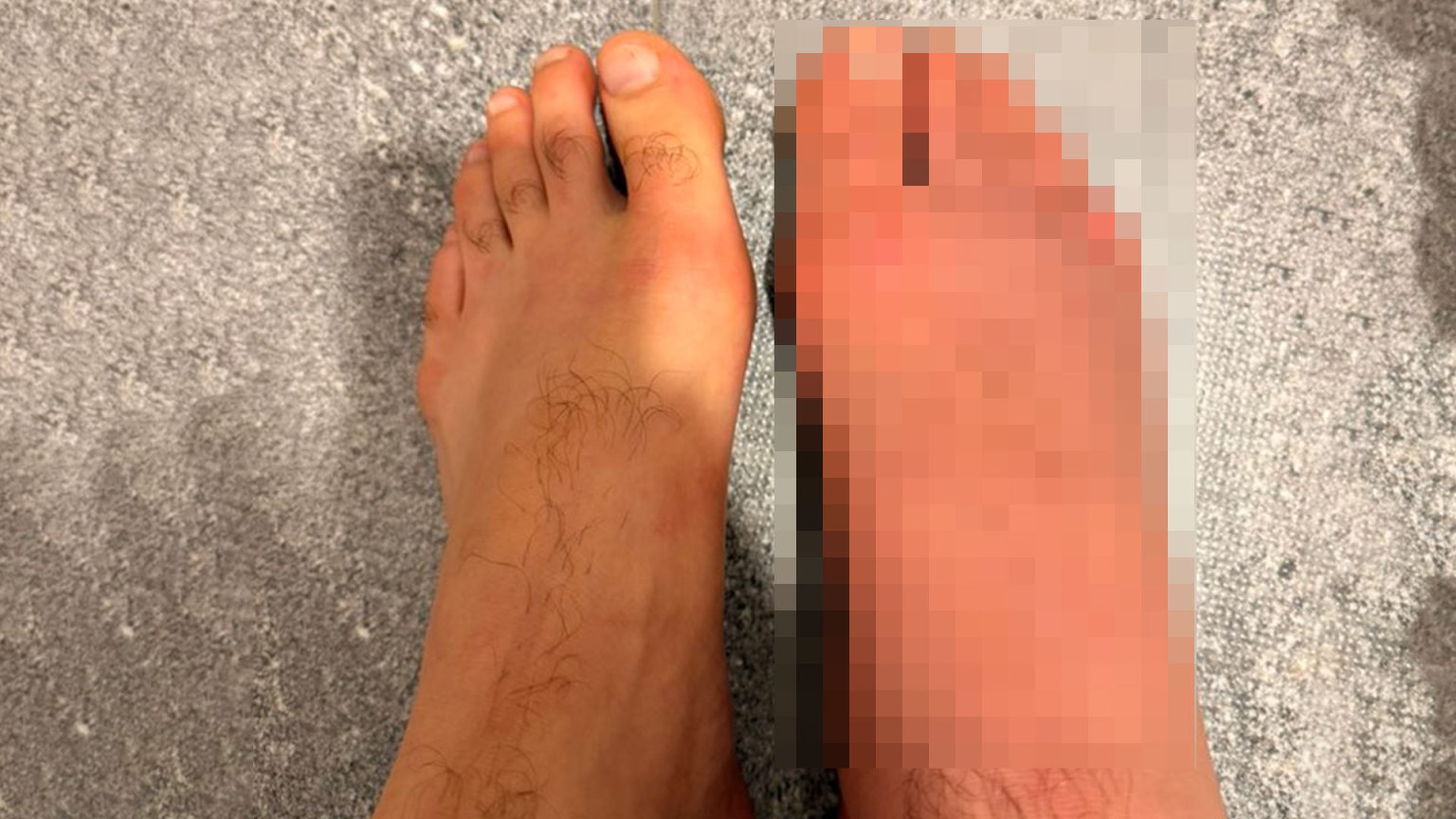 MMA star’s gruesomely swollen foot looks ‘like a balloon’ after savage head kick KO MMA star’s gruesomely swollen foot looks ‘like a balloon’ after savage head kick KO
