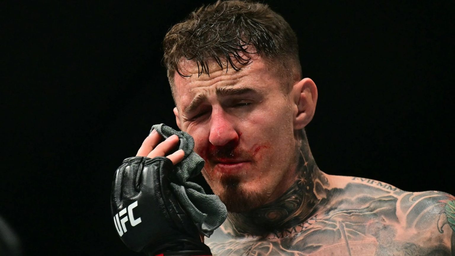 UFC star Tom Aspinall forced to undergo major surgery on ‘nightmare’ eye injury suffered against Ciryl Gane